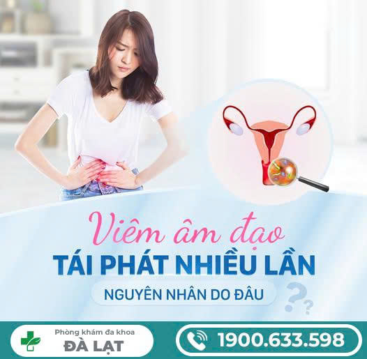 Hình ảnh minh họa